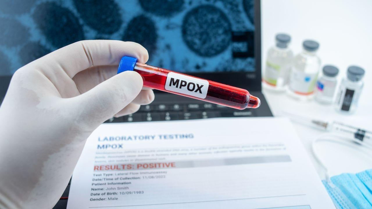 Netherlands Reports First Case of New Mpox Variant