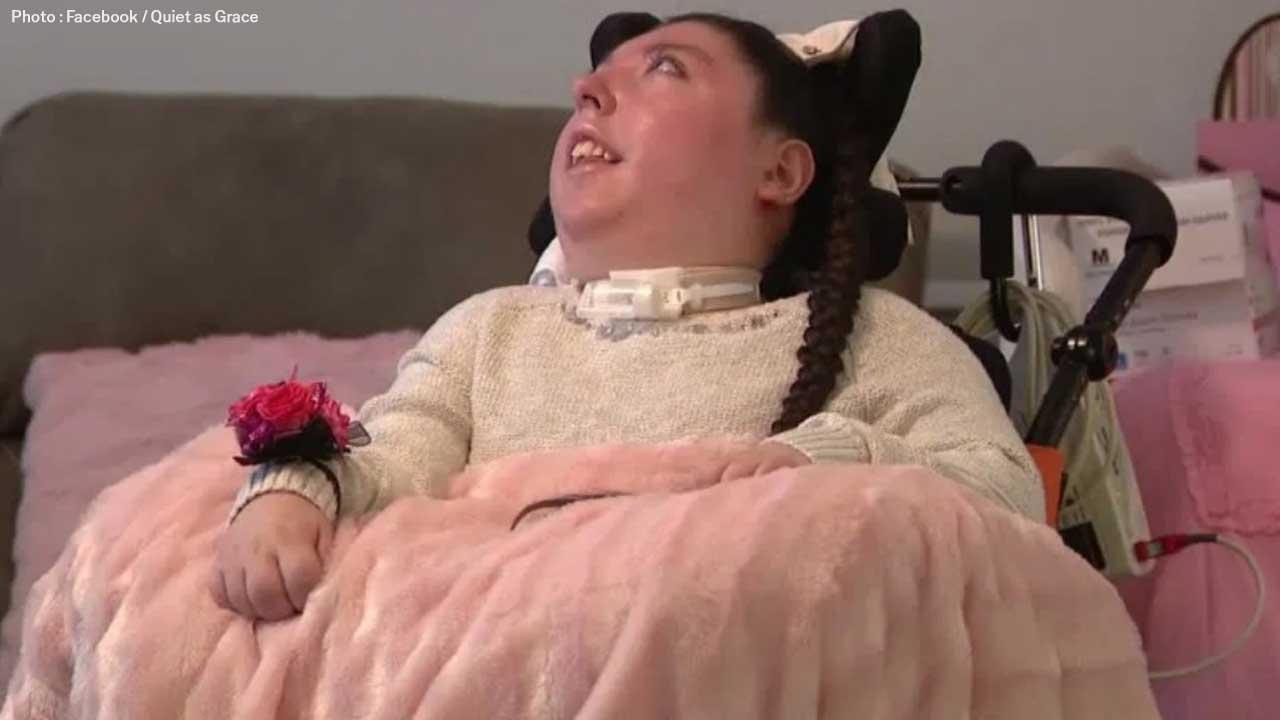 Omaha Woman Born Without Brain Celebrates 20th Milestone