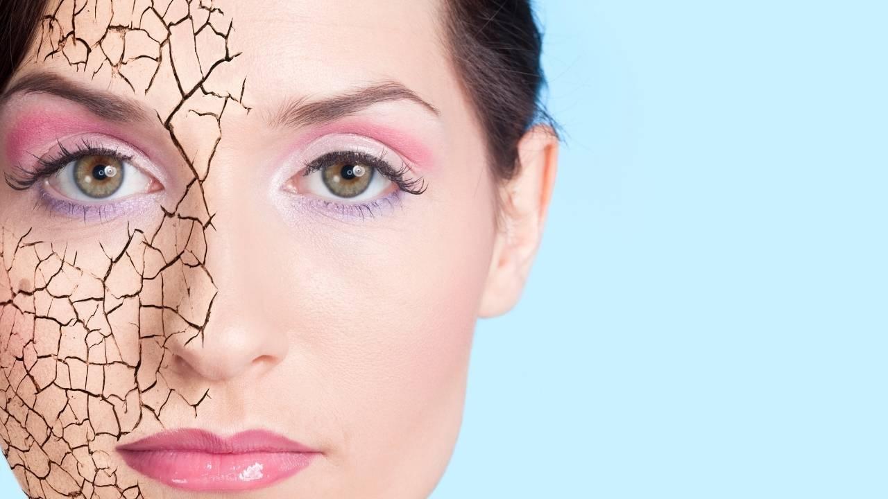 Essential Winter Skincare: 5 Tips for Hydrating Your Skin