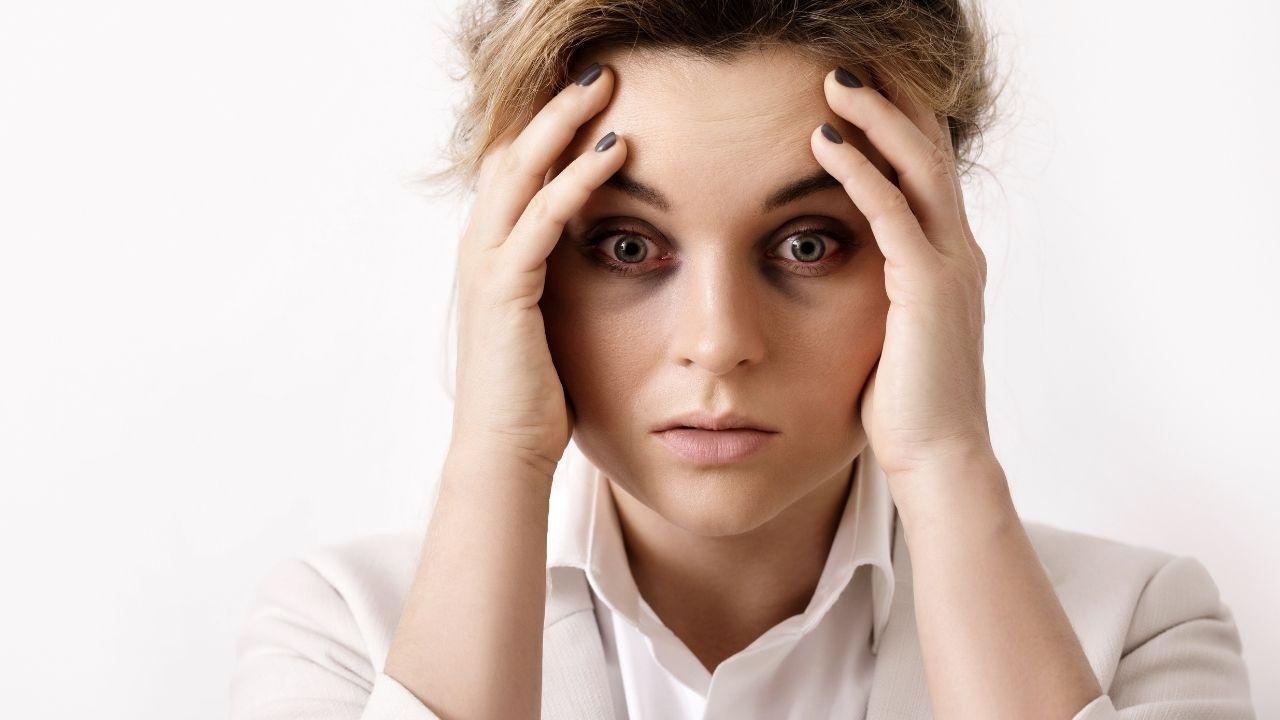 Eliminate Dark Circles with These 10 Effective Home Remedies