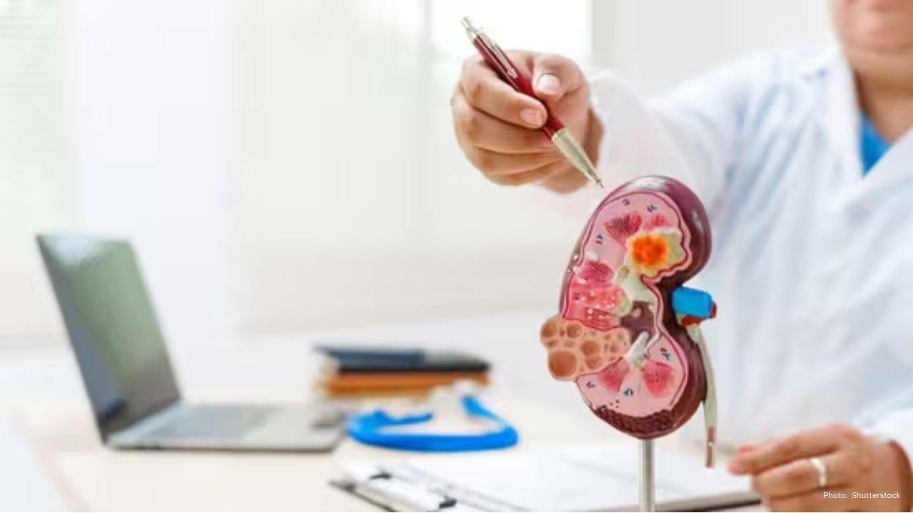 Breakthrough at UC Santa Barbara: New Approach to Combat Polycystic Kidney Disease