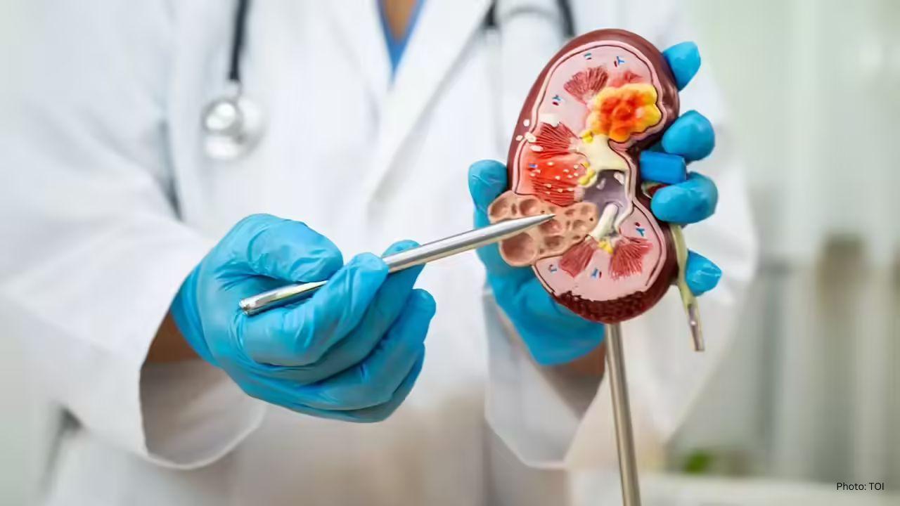 6 Practical Tips to Avoid Kidney Stones This Winter