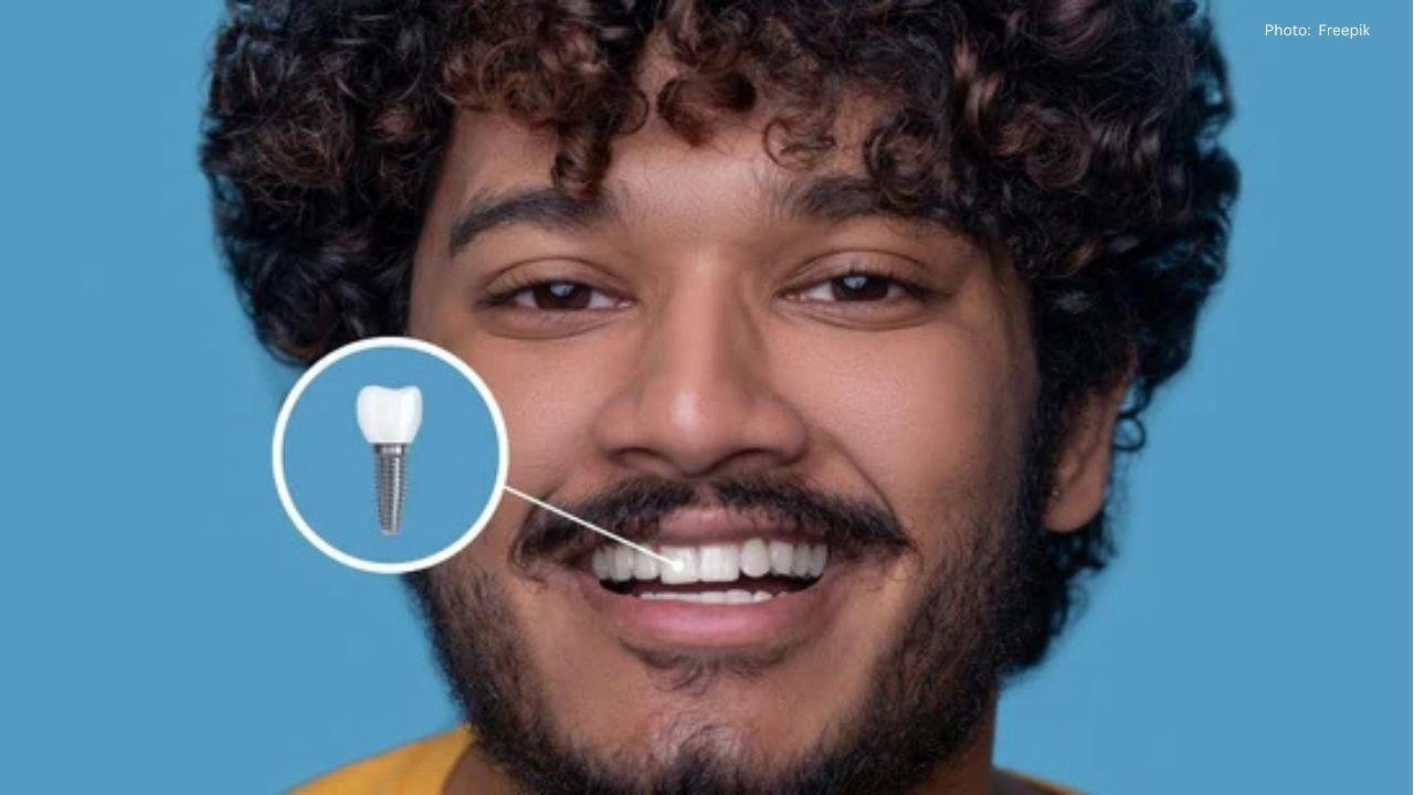 Expert Insights on the Lifespan of Dental Implants from a Mumbai Surgeon