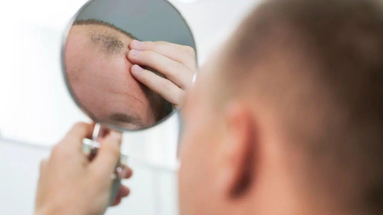 Top 5 Natural Oils for Hair Regrowth on Bald Spots