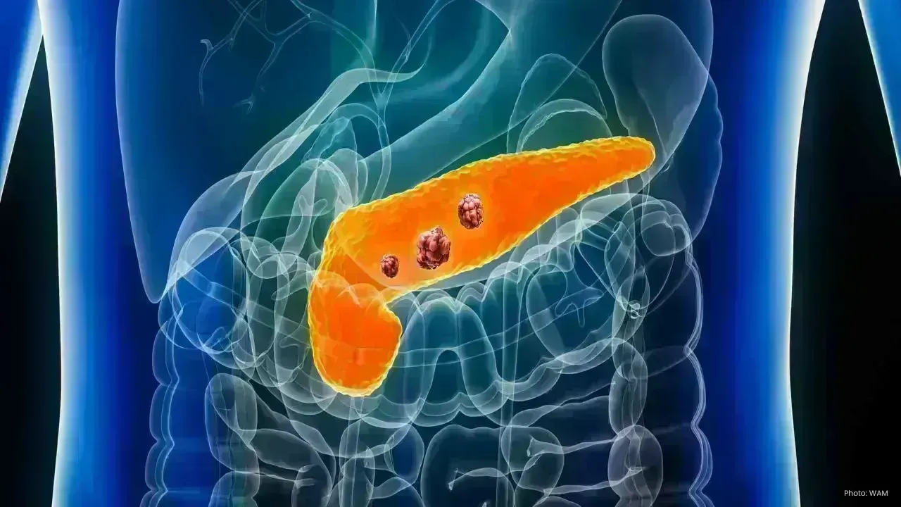 Revolutionary Oral Medication Enhances Survival Rates in Pancreatic Cancer