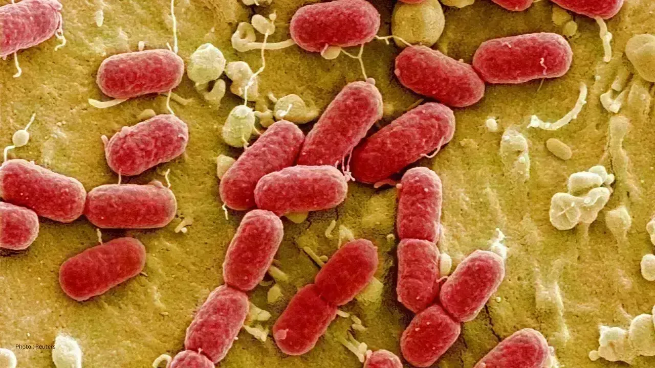 Spike in Salmonella Cases Tied to Hamilton Eatery