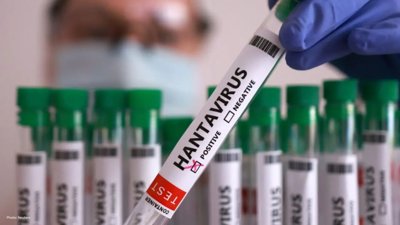 Another British Case of Hantavirus Linked to MV Hondius Cruise