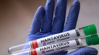 Ongoing Research for Hantavirus Treatments and Vaccines